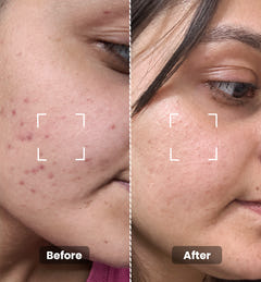 2% Hyaluronic Serum - Intense Hydration 20ml