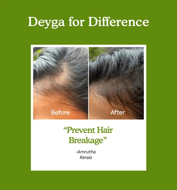 Hair Growth Oil