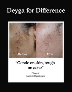 charcoal bath soap befor and after difference