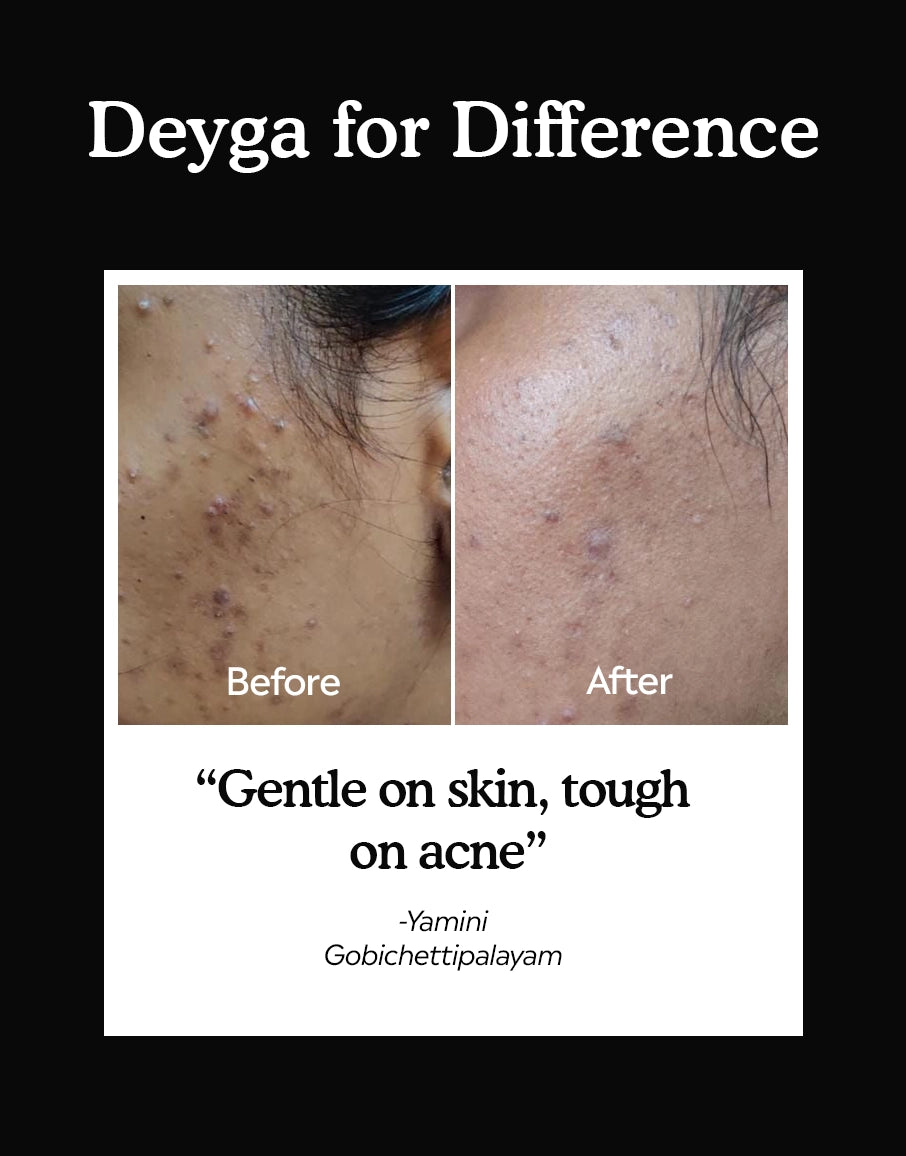 charcoal bath soap befor and after difference