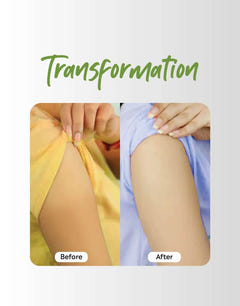 Transformation befor and after using Deyga De-Tan & Anti-Pigmentation Combo