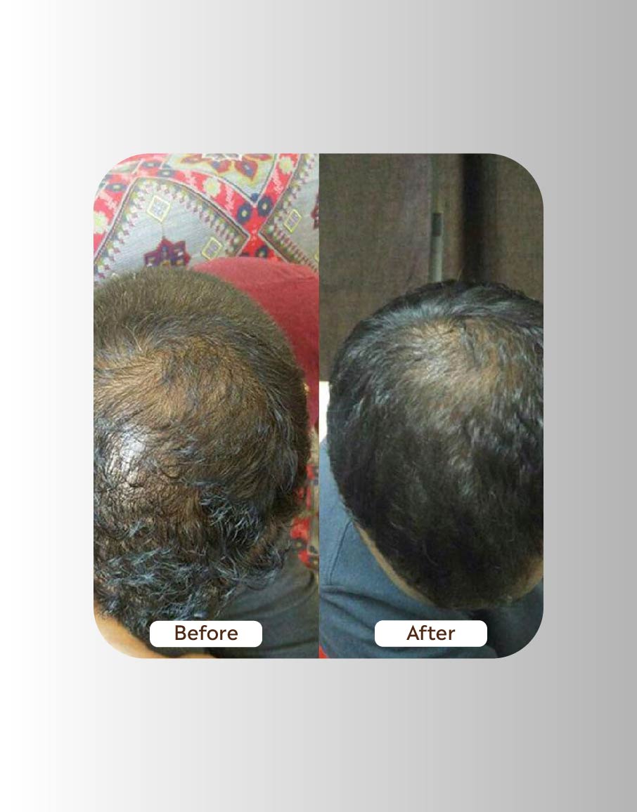 Hair Growth Oil