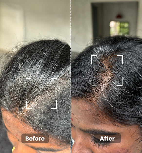 Build-Up Remover