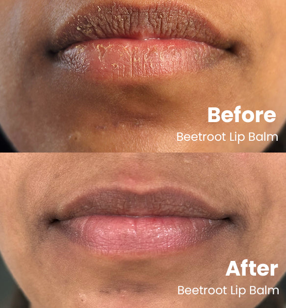 Beetroot Lip Balm - Tinted