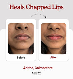 Beetroot Lip Balm