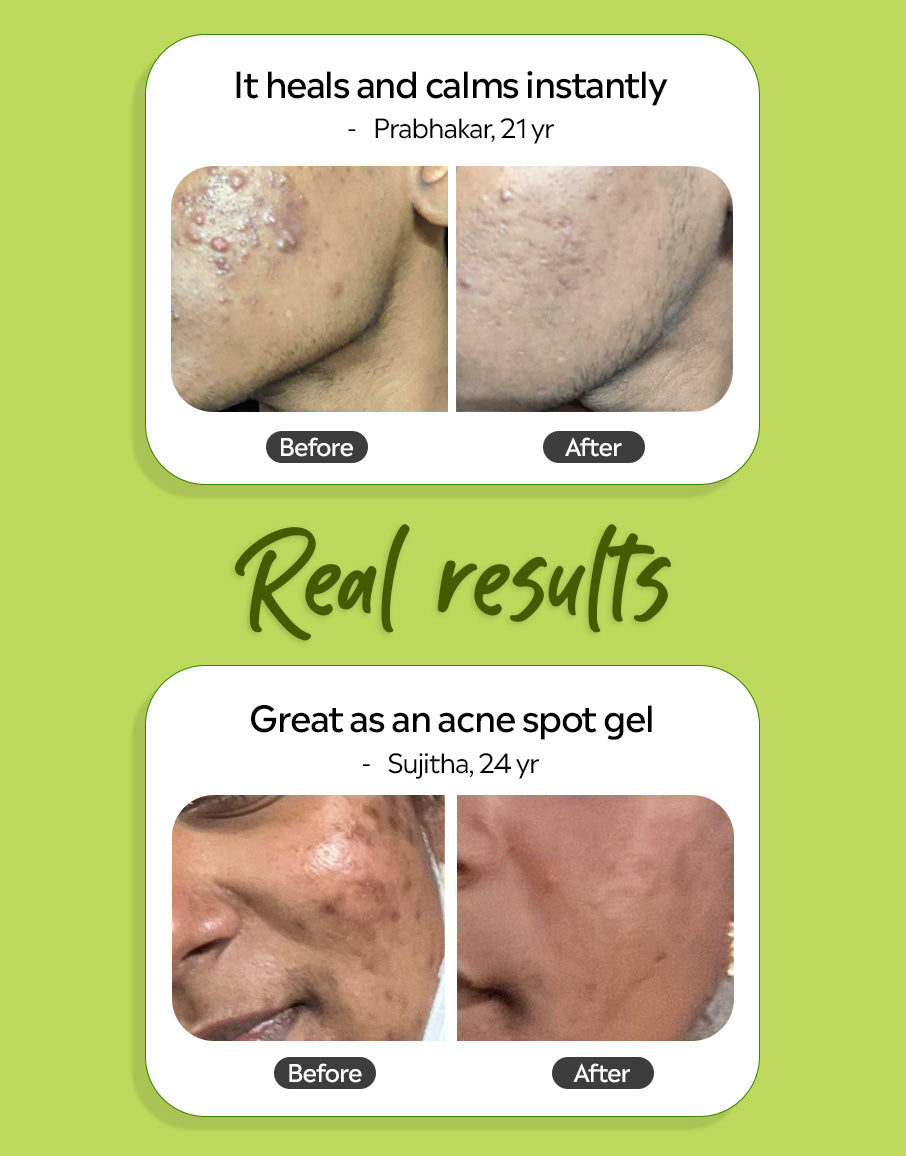 Aloe Vera Gel