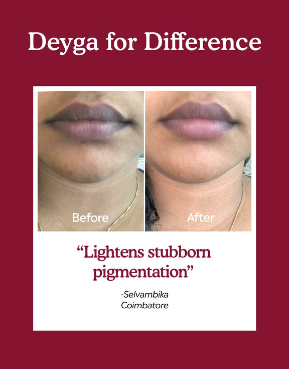 Deyga Beetroot Lip Balm - before and  after diference