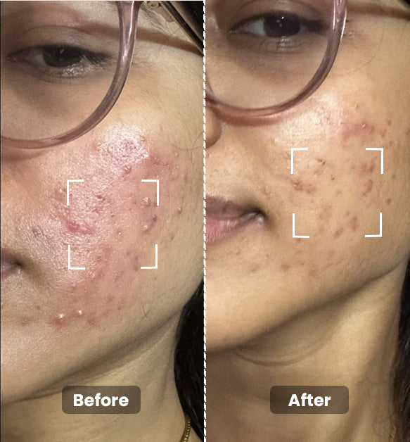 Charcoal Face Wash 100ml