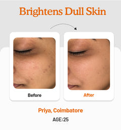 Vitamin C Daily Glow Combo