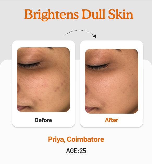 Vitamin C Daily Glow Combo