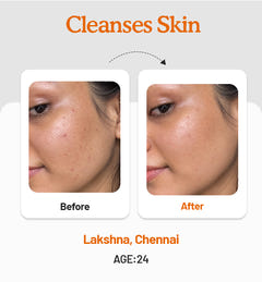 Vitamin C Daily Glow Combo