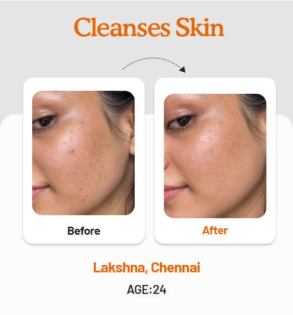 Vitamin C Daily Glow Combo