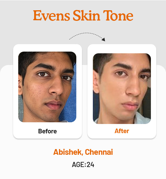 Vitamin C Daily Glow Combo