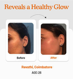 Vitamin C Daily Glow Combo