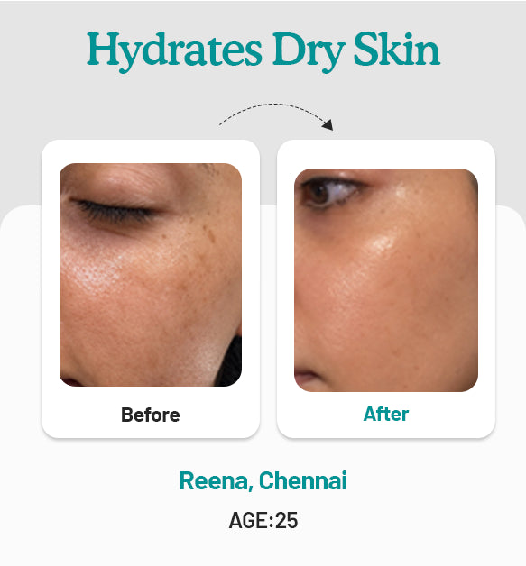 Buy Natural Face Moisturiser Online | Best for Dry skin