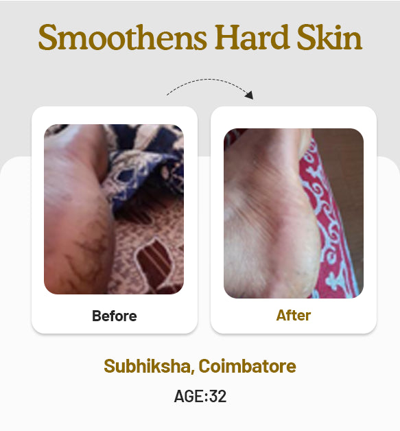 Foot Butter 40g