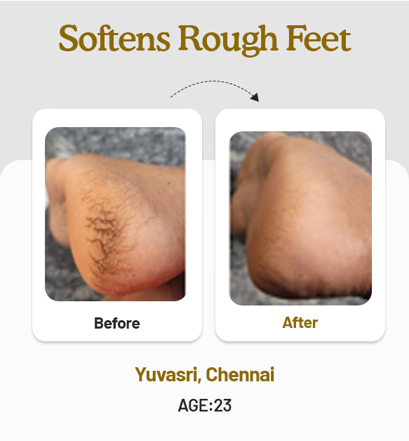 Foot Butter 40g