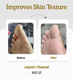 Foot Butter 40g