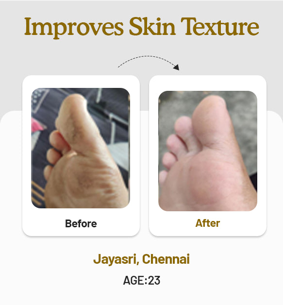 Foot Butter 40g