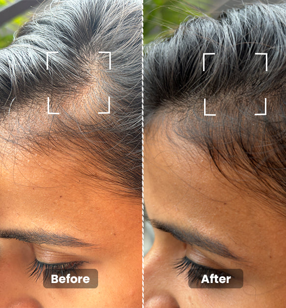 Hair Growth Oil