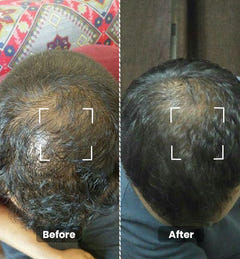 Hair Growth Oil Mini 50ml