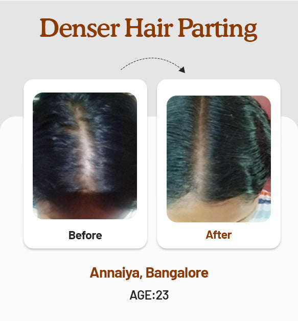 Hair Growth Oil