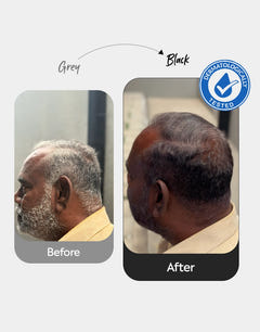 Scalp safe hair color before after - Herbal hair color change before and after - Visible results of natural hair color