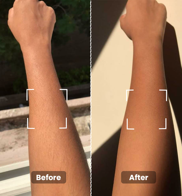 Instant Hair Removal Combo