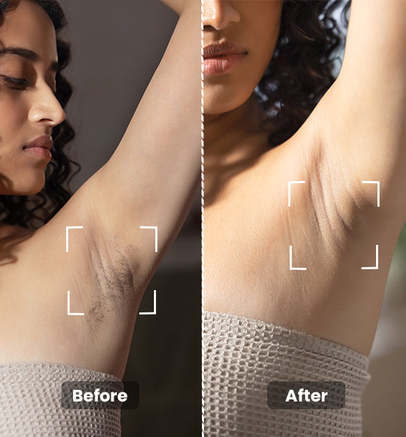 Instant Hair Removal Combo