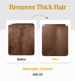 Hair Removal Powder 100g
