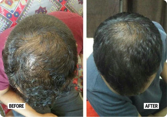 Deyga Hair Care combo before and after
