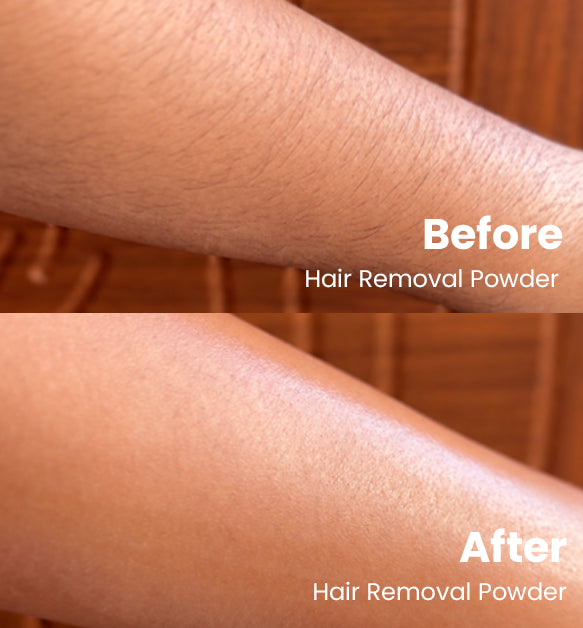 Instant Hair Removal Combo