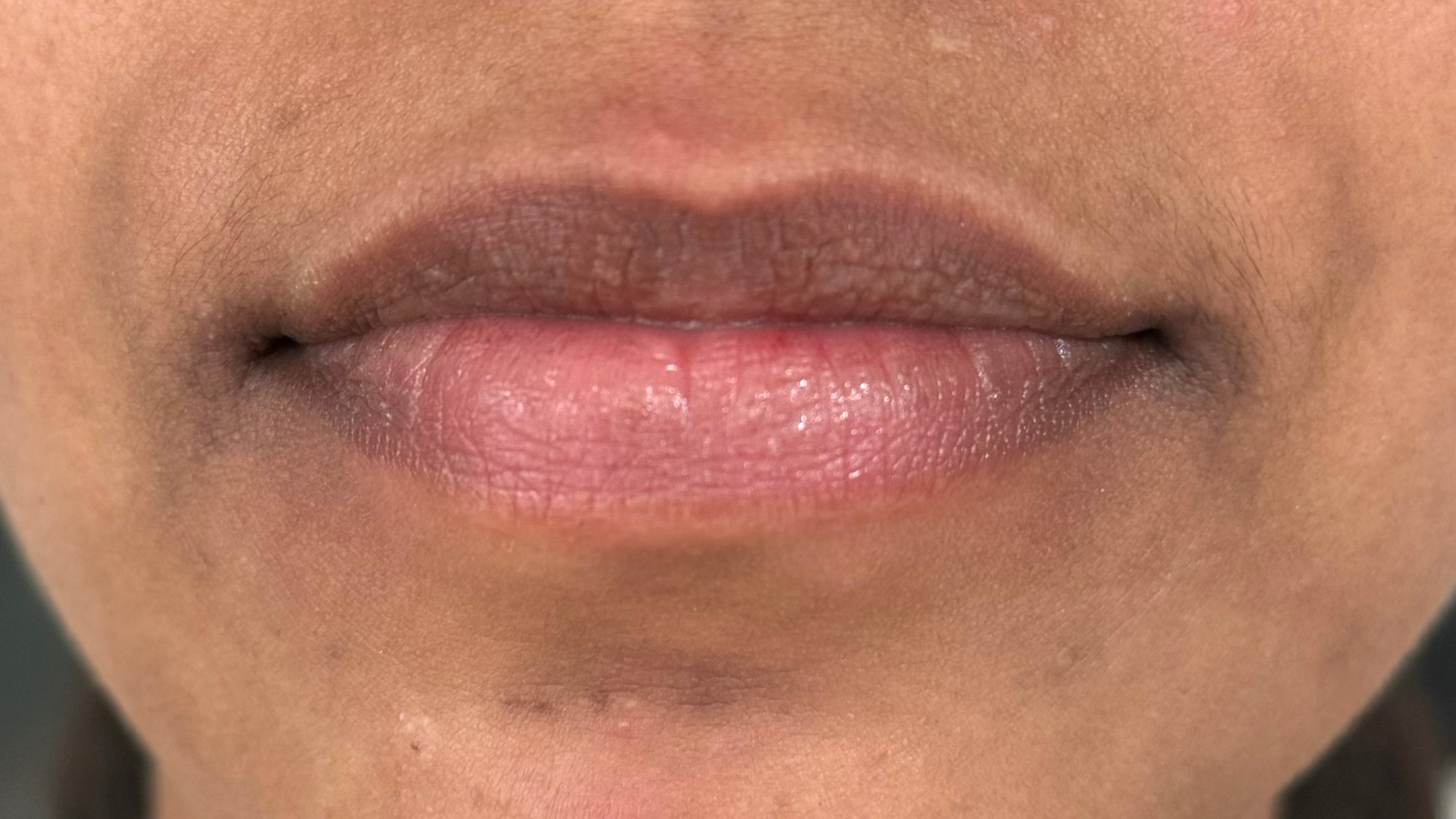 After image
