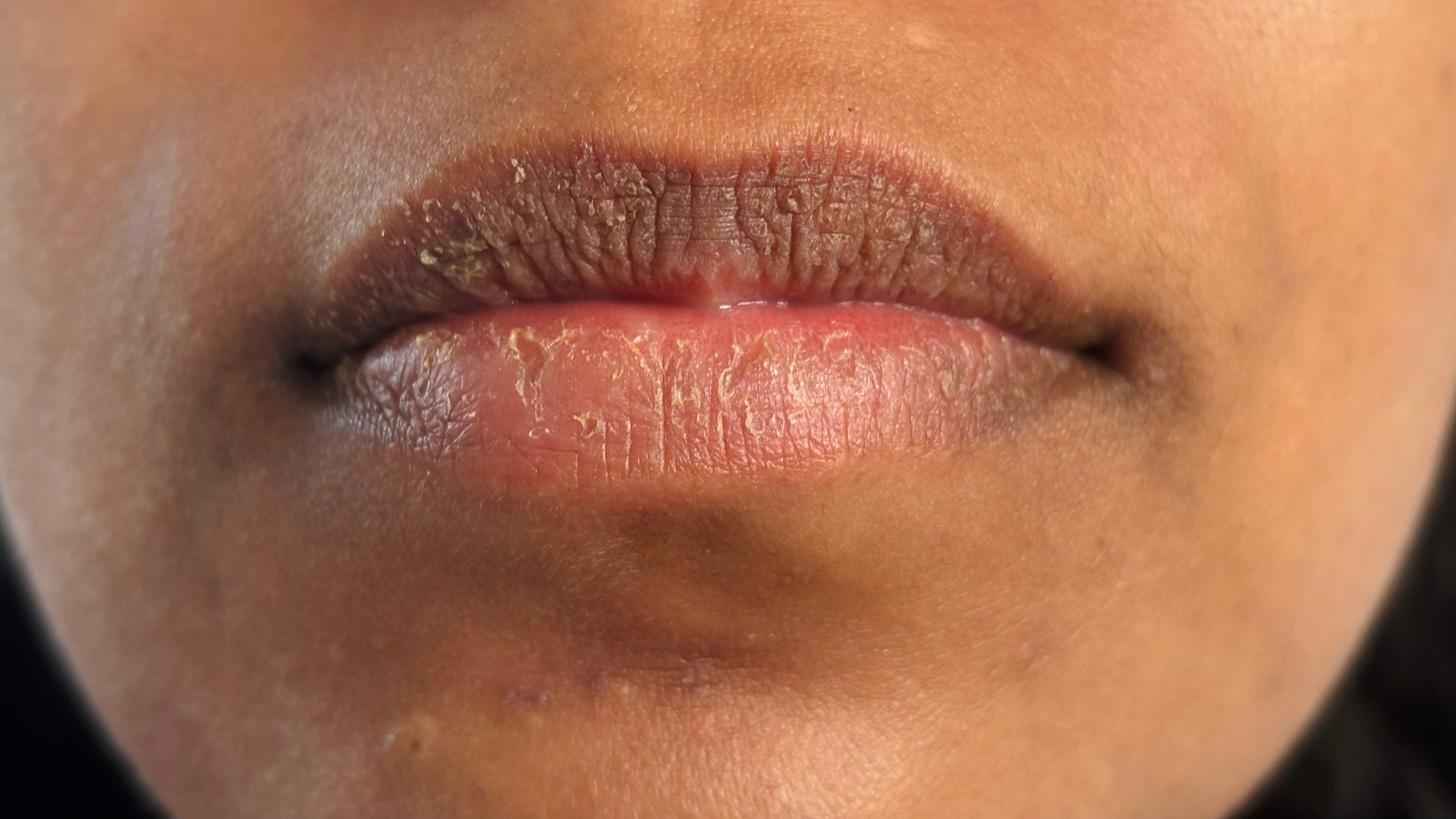Before image