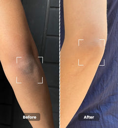 De-Tan & Anti-Pigmentation Combo