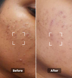 Tea Tree Toner Mini 50 ml
