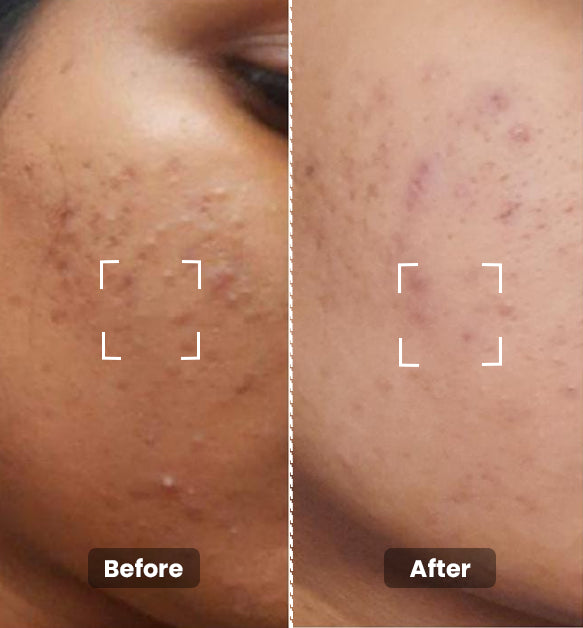 Tea Tree Toner Mini 50 ml