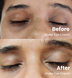 Under Eye Cream 15g