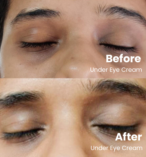 Under Eye Cream 15g