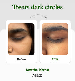 Under Eye Cream 15g