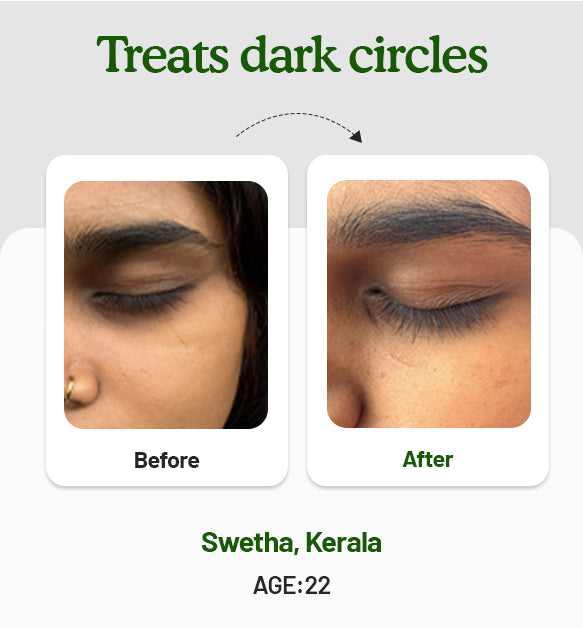 Under Eye Cream 15g