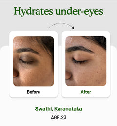Under Eye Cream 15g