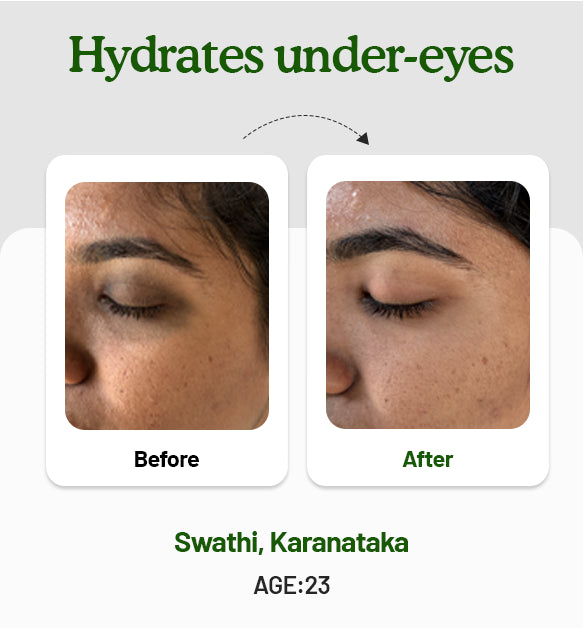 Under Eye Cream 15g