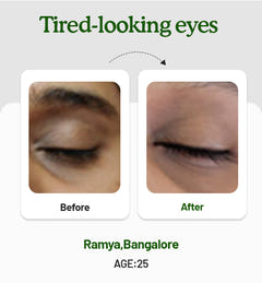 Under Eye Cream 15g