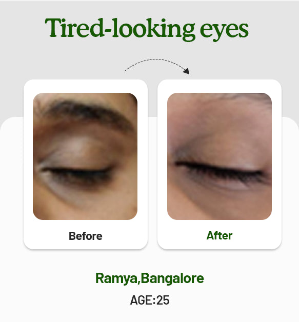 Under Eye Cream 15g