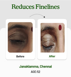Under Eye Cream 15g