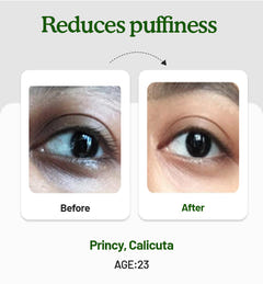 Under Eye Cream 15g