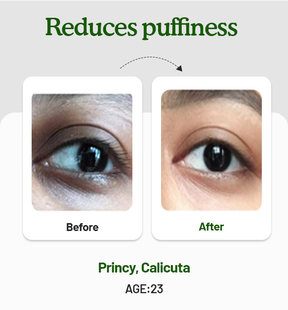 Under Eye Cream 15g