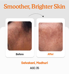 Vitamin C Daily Glow Combo
