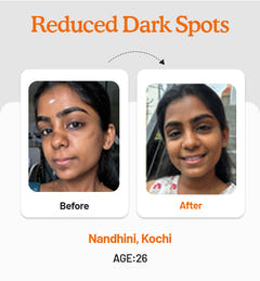 Vitamin C Daily Glow Combo